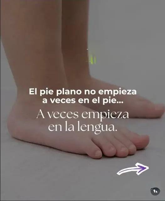 Publicación de odontologia_mdp sobre pie plano, lengua y desarrollo orofacial